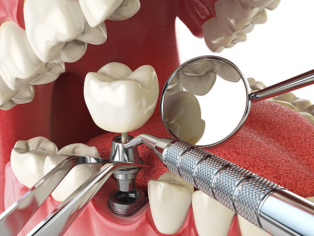 Best Emergency Dental Care for Trauma or Injury in Lemoore, CA